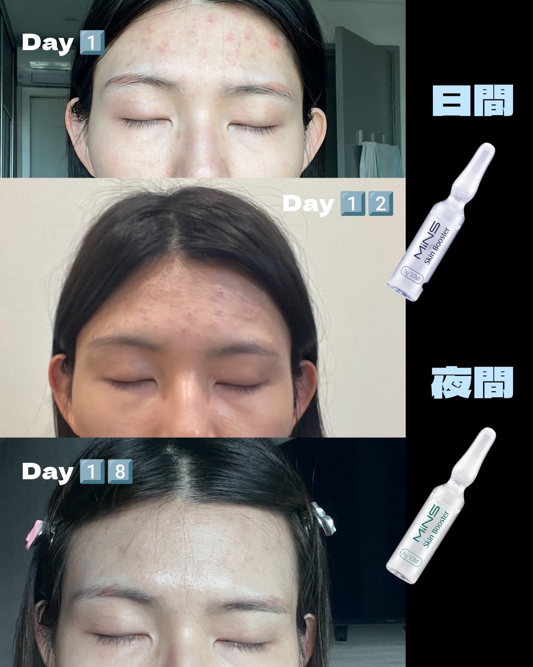 <MINS 護膚系列> 24HRS補水安瓶/SOS 修復安瓶